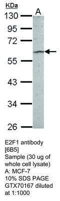 E2F1 antibody [6B5], GeneTex