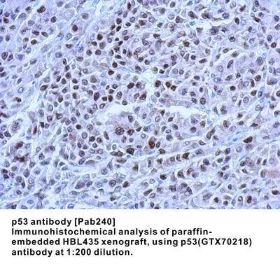 p53 antibody [Pab240], GeneTex