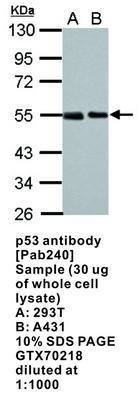 p53 antibody [Pab240], GeneTex