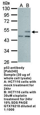 p53 antibody [Pab240], GeneTex