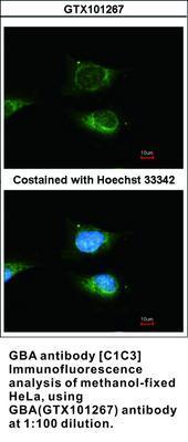 GBA antibody [C1C3], GeneTex