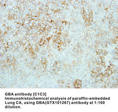 GBA antibody [C1C3], GeneTex