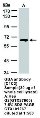 GBA antibody [C1C3], GeneTex