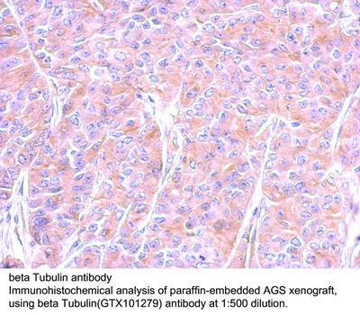 beta Tubulin antibody - Rabbit Polyclonal - ICC/IF, IHC-P, WB - 100µl, GeneTex