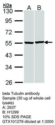 beta Tubulin antibody - Rabbit Polyclonal - ICC/IF, IHC-P, WB - 100µl, GeneTex