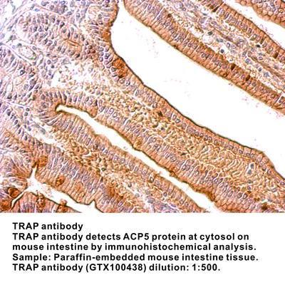 TRAP  antibody [N1C3], GeneTex