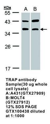 TRAP  antibody [N1C3], GeneTex