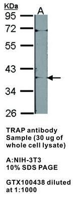 TRAP  antibody [N1C3], GeneTex