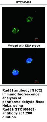 Rad51 antibody [N1C2], GeneTex