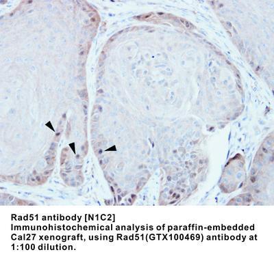 Rad51 antibody [N1C2], GeneTex