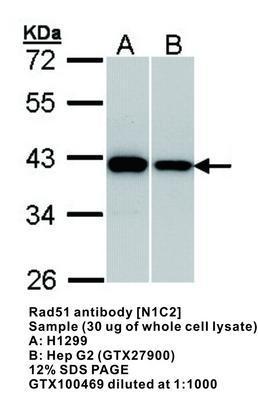 Rad51 antibody [N1C2], GeneTex