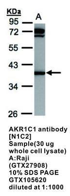 AKR1C1 antibody [N1C2], GeneTex