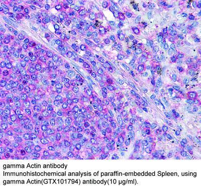 gamma Actin antibody, GeneTex