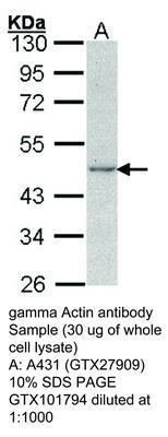 gamma Actin antibody, GeneTex