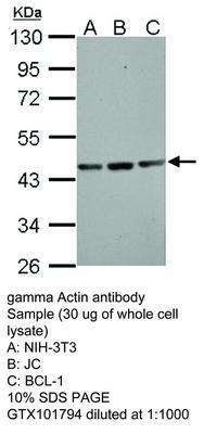 gamma Actin antibody, GeneTex