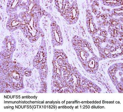 NDUFS5 antibody, GeneTex