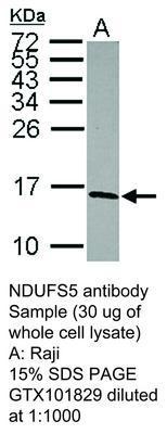 NDUFS5 antibody, GeneTex