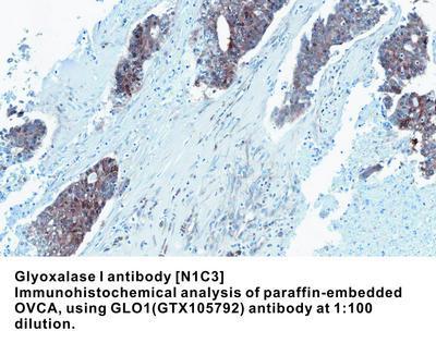 Glyoxalase I antibody [N1C3], GeneTex