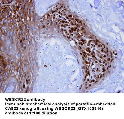 WBSCR22 antibody [N1C3], GeneTex