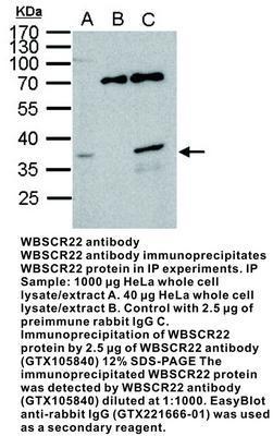 WBSCR22 antibody [N1C3], GeneTex