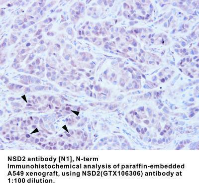 NSD2 antibody [N1], N-term, GeneTex