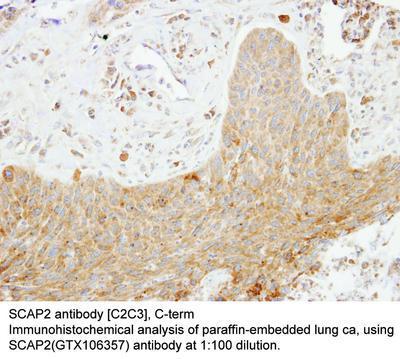 SCAP2 antibody [C2C3], C-term, GeneTex