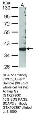 SCAP2 antibody [C2C3], C-term, GeneTex