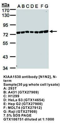 KIAA1530 antibody [N1N2], N-term, GeneTex