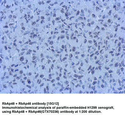 RbAp48 + RbAp46 antibody [15G12], GeneTex