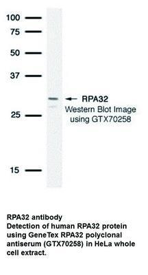 RPA32 antibody - 100µl, GeneTex