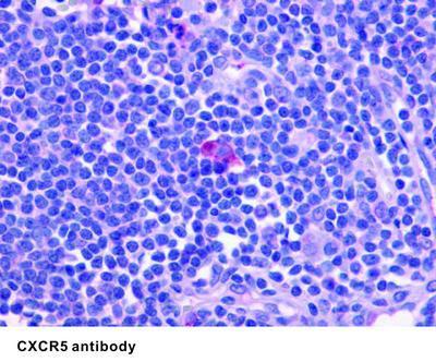 CXCR5 antibody, GeneTex