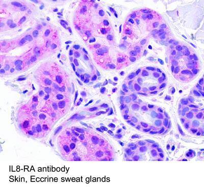 IL8-RA antibody, GeneTex