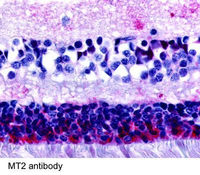 MT2 antibody (Extracellular Domain) - Rabbit Polyclonal - IHC-P - 25µg, GeneTex