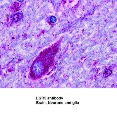 LGR5 antibody (Cytoplasmic Domain) - Rabbit Polyclonal - IHC-P - 25µg, GeneTex