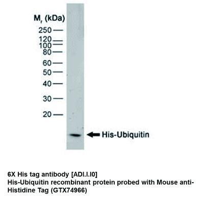 6X His tag antibody [ADI.I.I0], GeneTex