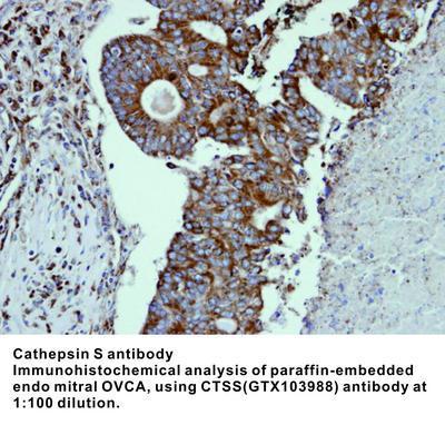 Cathepsin S antibody, GeneTex