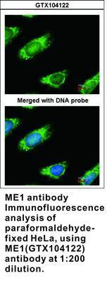 ME1 antibody, GeneTex