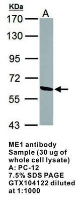 ME1 antibody, GeneTex