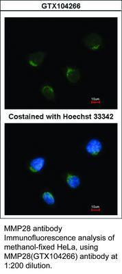 MMP28 antibody [N1C1], GeneTex