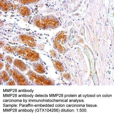 MMP28 antibody [N1C1], GeneTex