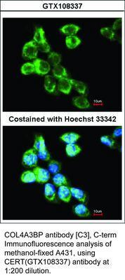 CES2 antibody, GeneTex