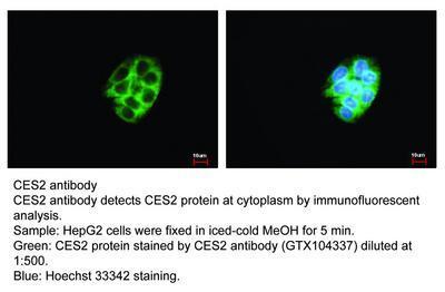 CES2 antibody, GeneTex