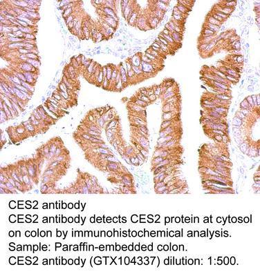 CES2 antibody, GeneTex