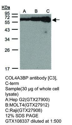 CES2 antibody, GeneTex