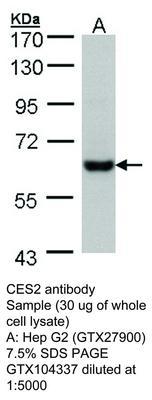 CES2 antibody, GeneTex