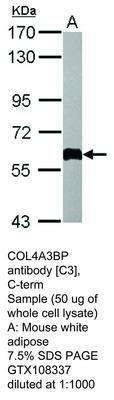 CES2 antibody, GeneTex