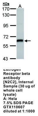 Estrogen Receptor beta antibody [N2C2], Internal, GeneTex