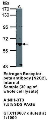 Estrogen Receptor beta antibody [N2C2], Internal, GeneTex