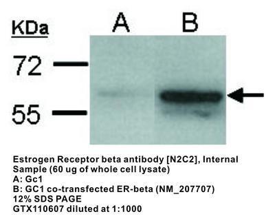 Estrogen Receptor beta antibody [N2C2], Internal, GeneTex