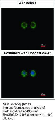 RAGE antibody [N2C3], GeneTex